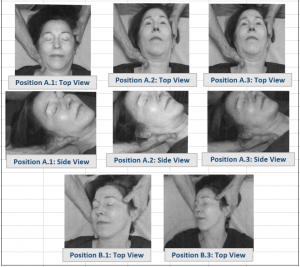 1a-Z12-Upper-Scalenes Middle Posterior - Climber